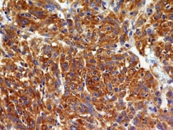 VEGFR2/KDR/Flk-1 Antibody (1B6) - BSA Free, Novus Biologicals 0.1mg; Unlabeled:Antibodies,
