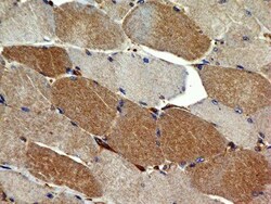 VEGFR2/KDR/Flk-1 Antibody (1B6) - BSA Free, Novus Biologicals 0.1mg; Unlabeled:Antibodies,