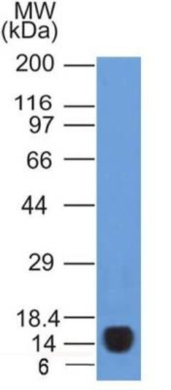 VEGFR2/KDR/Flk-1 Antibody (1B6) - BSA Free, Novus Biologicals 0.1mg; Unlabeled:Antibodies,