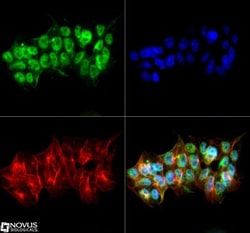 VEGFR2/KDR/Flk-1 Antibody, Novus Biologicals:Antibodies:Primary Antibodies