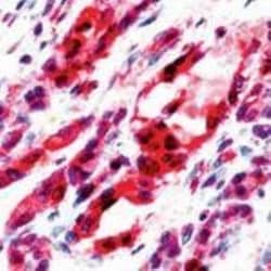 VEGFR2/KDR/Flk-1 Antibody, Novus Biologicals 0.1 mL; Unconjugated:Antibodies,