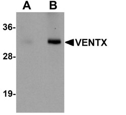 VENTX Antibody - BSA Free, Novus Biologicals 0.025 mg, Unconjugated:Antibodies,