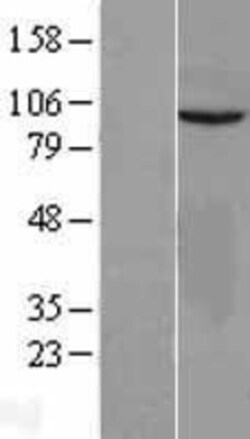 Novus Biologicals&trade;&nbsp;VEPH1 Overexpression Lysate