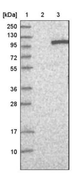 VEPH1 Antibody, Novus Biologicals 0.1mL; Unlabeled:Antibodies, Polyclonal