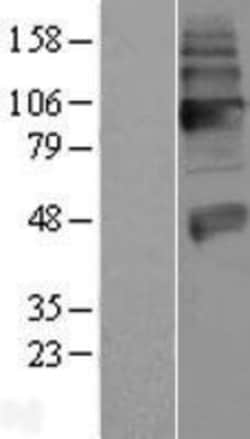 Novus Biologicals&trade;&nbsp;VAChT/SLC18A3 Overexpression Lysate