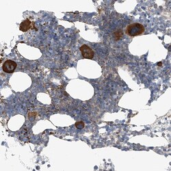 VGCNL1 Antibody, Novus Biologicals:Antibodies:Primary Antibodies