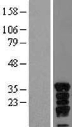 Novus Biologicals&trade;&nbsp;VGLL4 Overexpression Lysate