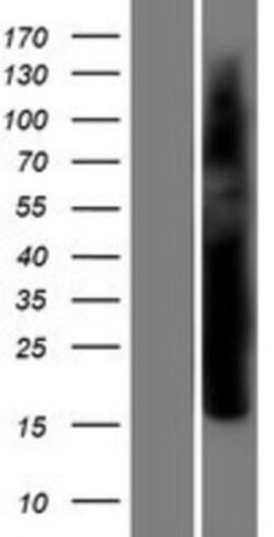 Novus Biologicals&trade;&nbsp;VGLL4 Overexpression Lysate