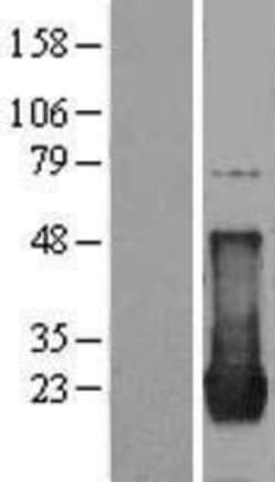 Novus Biologicals&trade;&nbsp;HRAS Overexpression Lysate