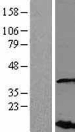 Novus Biologicals™ VHLL Overexpression Lysate