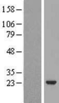 Novus Biologicals&trade;&nbsp;VILIP3 Overexpression Lysate