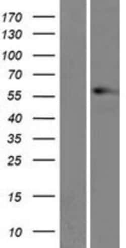 Novus Biologicals&trade;&nbsp;Vimentin Overexpression Lysate