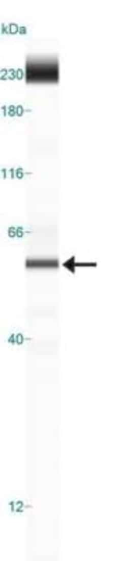 Vimentin Antibody (2D1), Novus Biologicals 0.025mL; Unlabeled:Antibodies,