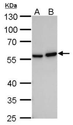 Vimentin Antibody (812), Novus Biologicals 0.1mL; Unlabeled:Antibodies,