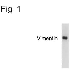 Vimentin Antibody (J144), Novus Biologicals:Antikörper:Primärantikörper