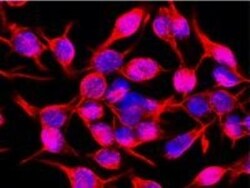 Vimentin Antibody (VI-10), Novus Biologicals 0.1mg; Unlabeled:Antibodies,