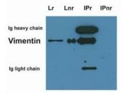 Vimentin Antibody (VI-10), Novus Biologicals 0.1mg; Unlabeled:Antibodies,