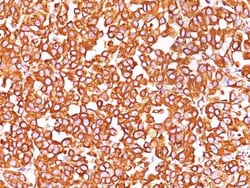 Vimentin Antibody (VM452), Novus Biologicals 0.1mg; Unlabeled:Antibodies,