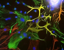 Vimentin Antibody, Novus Biologicals:Antibodies:Primary Antibodies