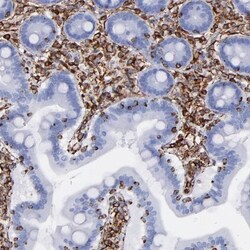 Vimentin Antibody, Novus Biologicals:Antibodies:Primary Antibodies