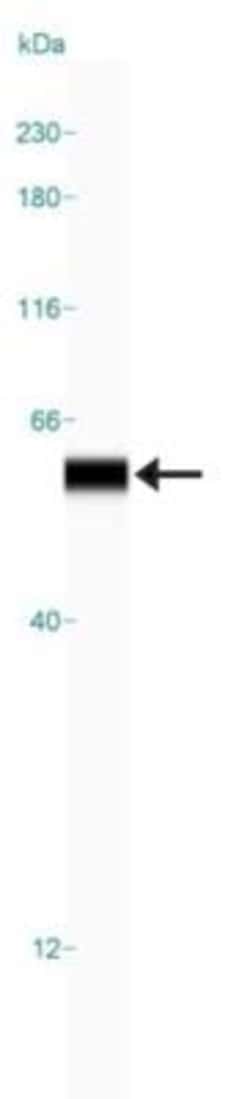 Vimentin Antibody, Novus Biologicals:Antibodies:Primary Antibodies