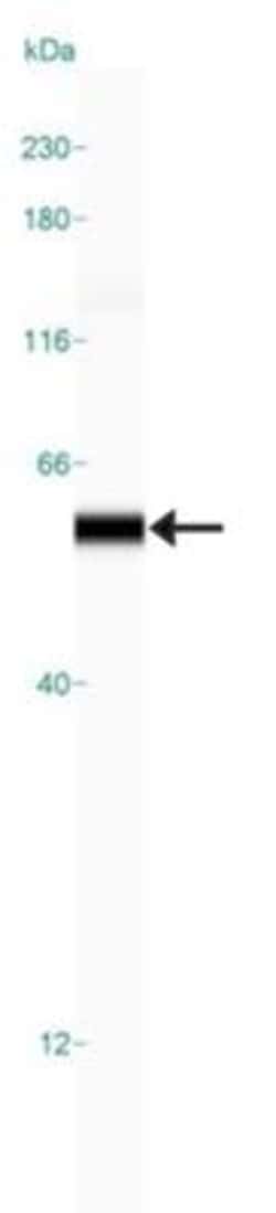 Vimentin Antibody, Novus Biologicals:Antibodies:Primary Antibodies