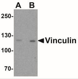 Vinculin Antibody - BSA Free, Novus Biologicals:Antibodies:Primary Antibodies