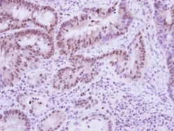 Vinexin Antibody, Novus Biologicals 0.1mL; Unlabeled:Antibodies, Polyclonal