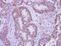 Vinexin Antibody, Novus Biologicals 0.1mL; Unlabeled:Antibodies, Polyclonal