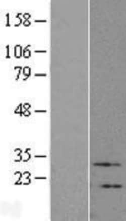 Novus Biologicals&trade;&nbsp;VIP Overexpression Lysate