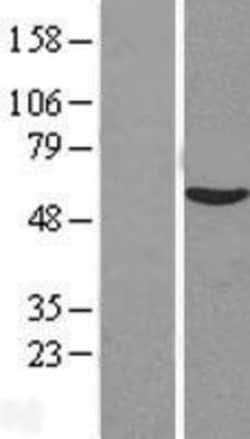 Novus Biologicals™ VIPAR Overexpression Lysate