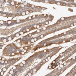 VIPAR Antibody, Novus Biologicals:Antibodies:Primary Antibodies