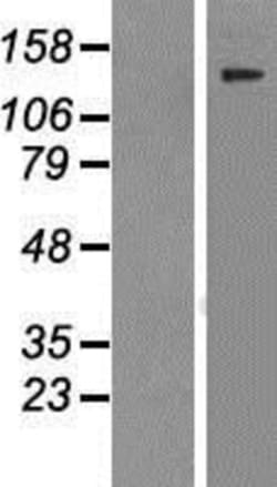 Novus Biologicals&trade;&nbsp;Virilizer Overexpression Lysate