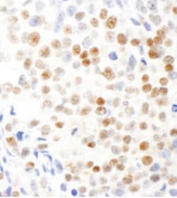 Virilizer Antibody, Novus Biologicals 0.1mg; Unlabeled:Antibodies, Polyclonal