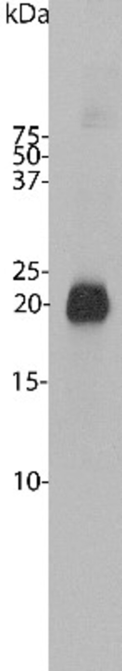 visinin-like 1 Antibody, Novus Biologicals 0.1mL; Unlabeled:Antibodies,
