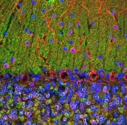 visinin-like 1 Antibody (3A9), Novus Biologicals:Antibodies:Primary Antibodies
