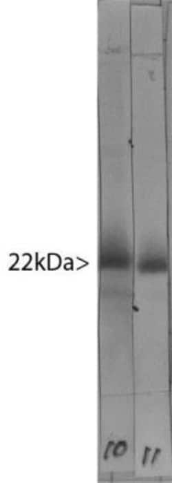 visinin-like 1 Antibody (3A9), Novus Biologicals:Antibodies:Primary Antibodies