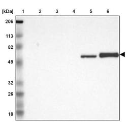 Vitamin D BP Antibody, Novus Biologicals:Antibodies:Primary Antibodies