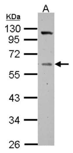 Vitamin D BP Antibody, Novus Biologicals 0.1mL; Unlabeled:Antibodies, Polyclonal