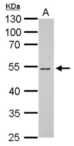Vitamin D BP Antibody, Novus Biologicals 0.1mL; Unlabeled:Antibodies, Polyclonal