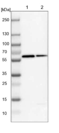 Vitamin D BP Antibody, Novus Biologicals 0.1mL; Unlabeled:Antibodies, Polyclonal
