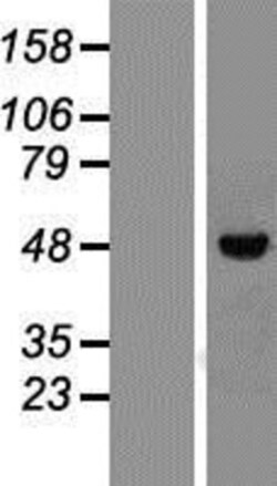 Novus Biologicals™ VDR/NR1I1/Vitamin D Receptor Overexpression Lysate