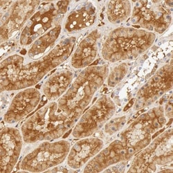 Vitamin D BP Antibody, Novus Biologicals:Antibodies:Primary Antibodies