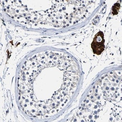 VMA21 Antibody, Novus Biologicals 0.1mL; Unlabeled:Antibodies, Polyclonal