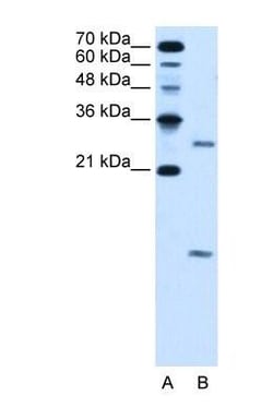 VMA21 Antibody, Novus Biologicals 20&mu;L; Unlabeled:Antibodies, Polyclonal