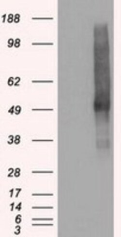 VMAT2 Antibody (OTI9E11), Novus Biologicals 0.1mL; Unlabeled:Antibodies,