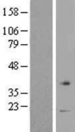 Novus Biologicals&trade;&nbsp;VN1R1 Overexpression Lysate