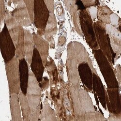 ACRC Antibody, Novus Biologicals:Antibodies:Primary Antibodies