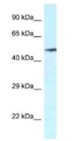 VNN2 Antibody, Novus Biologicals 100&mu;L; Unlabeled:Antibodies, Polyclonal
