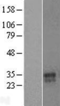 Novus Biologicals&trade;&nbsp;VNN3 Overexpression Lysate